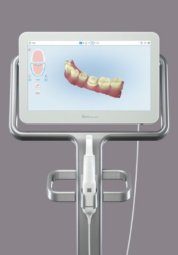 Como funciona Invisalign - Passo 2 Escaneamento 3D