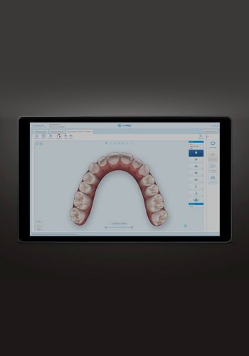 Como funciona Invisalign - Passo 5 Plano de Tratamento Invisalign