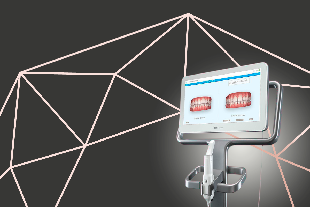 Read more about the article Ortodontia Digital Invisalign, o que é e como se faz o tratamento